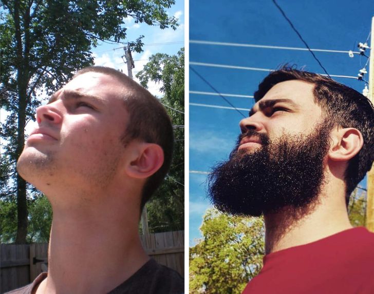 Рост бороды по дням с фото